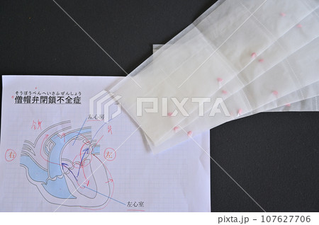 僧帽弁閉鎖不全症　心臓病　錠剤　犬　診察　通院 107627706