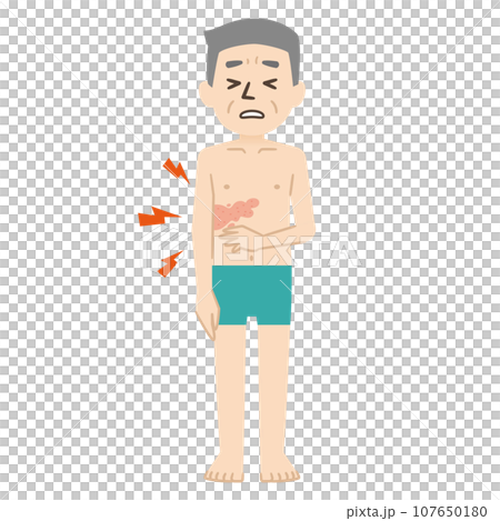 表達帶狀皰疹的皮疹和疼痛的插圖 表達帶狀皰疹的皮疹和疼痛的插圖 107650180