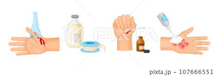 Hands with Injured Skin and Wound First Aid Vector Set 107666551