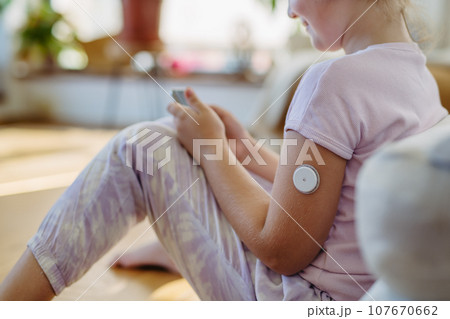 Diabetic girl with continuous glucose monitor on arm. The CGM device makes the life of schoolgirl easier, helping manage illness and focus on other activities. 107670662