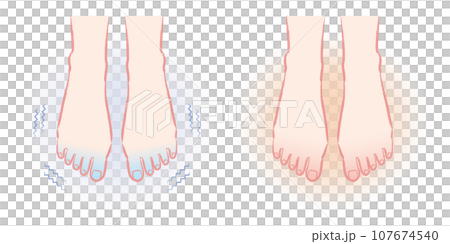 Feet that are sensitive to cold. Illustration of warm feet before and after. 107674540