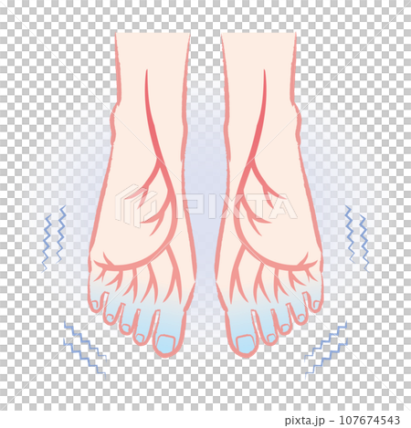 末端冷え性 血流の悪い冷えた足先のイラスト 末端冷え性 血流の悪い冷えた足先のイラスト 107674543