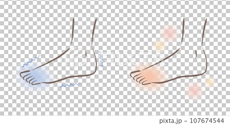 Feet that are sensitive to cold. Illustration of warm feet before and after. 107674544