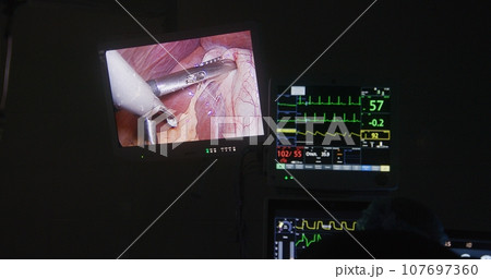 Monitor screen with view from laparoscopic camera 107697360
