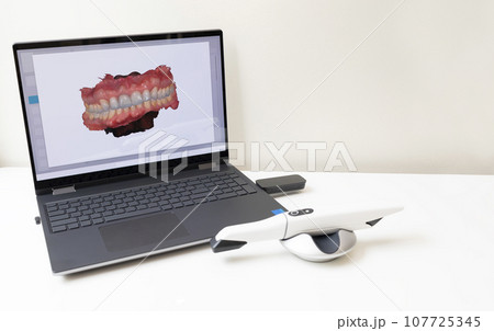 3D Scanned Picture of Scanned Teeth on Monitor of Computer, Notebook. White 3d Intraoral Dental Tooth Scanner Lying on Table. Copy Space. Dental Equipment, Device For Scanning Teeth. Horizontal 107725345