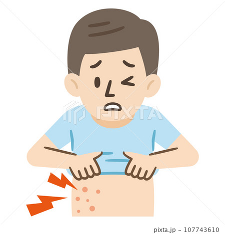 帯状疱疹の症状イラスト 帯状疱疹の症状イラスト 107743610