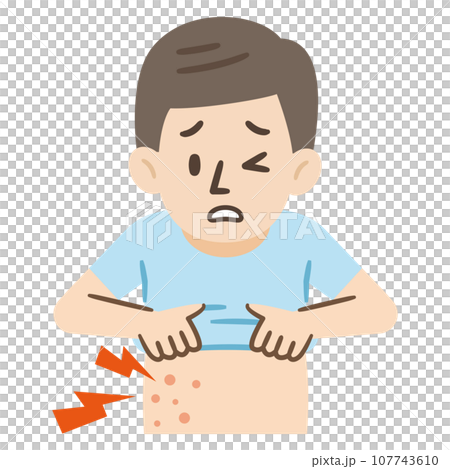 帯状疱疹の症状イラスト 帯状疱疹の症状イラスト 107743610