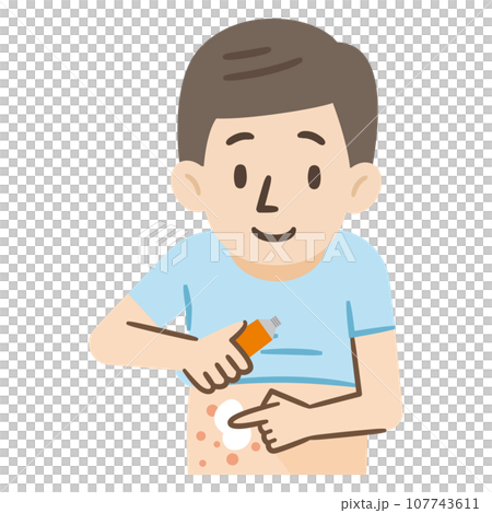 Illustration of a man applying medicine to eczema Illustration of a man applying medicine to eczema 107743611