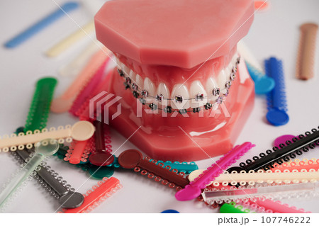 Orthodontic ligatures rings and ties, elastic rubber bands on orthodontic braces, model for dentist studying about dentistry. 107746222