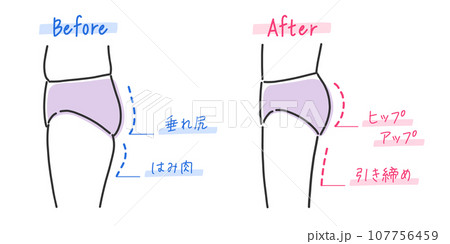 垂れ尻と美尻の比較イラスト素材 垂れ尻と美尻の比較イラスト素材 107756459