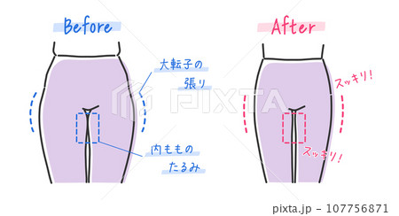 女性の下半身の比較イラスト素材 107756871