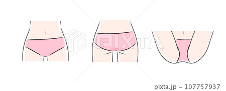 女性のビキニラインのカラーイラスト2　VIO 107757937