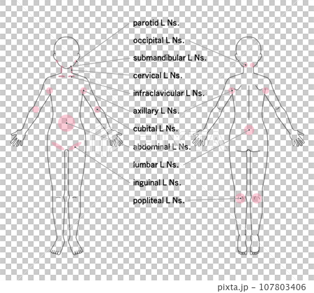 Location of major lymph nodes throughout the body Location of major lymph nodes throughout the body 107803406