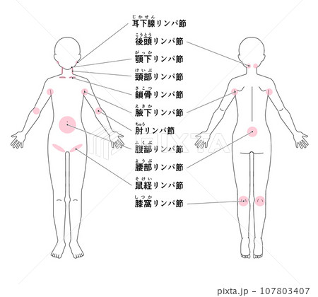 全身の主なリンパ節の位置 107803407