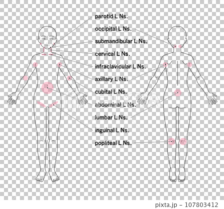 全身の主なリンパ節の位置 全身の主なリンパ節の位置 107803412