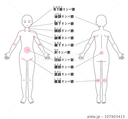 全身の主なリンパ節の位置 全身の主なリンパ節の位置 107803413