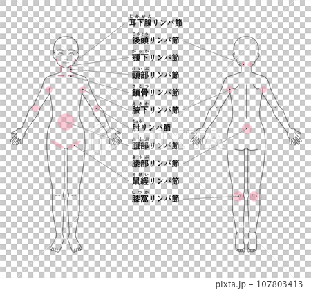 全身の主なリンパ節の位置 全身の主なリンパ節の位置 107803413