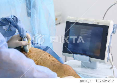 Medical surgery for endovenous laser photocoagulation of the great saphenous vein. Miniphlegectomy. Endovenous laser coagulation vein. Medical surgery for endovenous laser photocoagulation of the great saphenous vein. Miniphlegectomy. Endovenous laser coagulation vein. 107804217