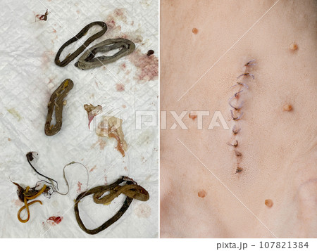 Cat Intestinal Blockage. Intestinal contents and suture scar closeup Cat Intestinal Blockage. Intestinal contents and suture scar closeup 107821384
