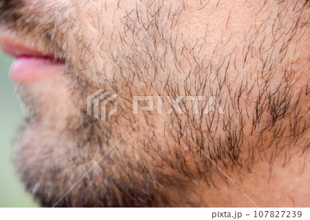Bearded male chin. Beard on the face of a young man. 107827239