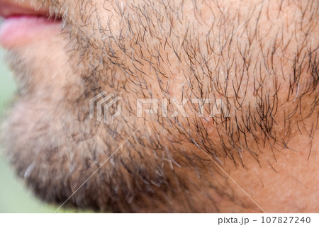 Bearded male chin. Beard on the face of a young man. Bearded male chin. Beard on the face of a young man. 107827240