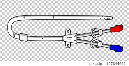 血液透析用ダブルルーメンカテーテル(カフ付き, 対象型先端)のイラスト 107844661