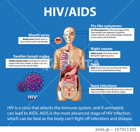 HIV/AIDS Virus: Effects on Human Immune System HIV/AIDS Virus: Effects on Human Immune System 107921305