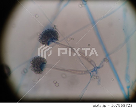 仮根が観察できるクモノスカビ 107968722