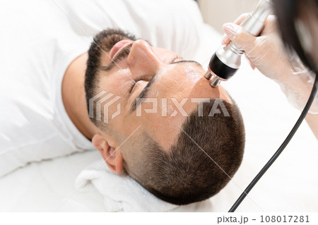 Radio frequency lifting known as a RF-lifting treatment for man patient Radio frequency lifting known as a RF-lifting treatment for man patient 108017281