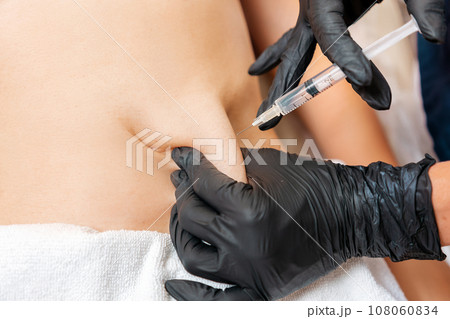 Liposuction. Doctor cosmetologist makes an injection of lipolytics into the client's belly. Close up. Aesthetic medicine and plastic surgery Liposuction. Doctor cosmetologist makes an injection of lipolytics into the client's belly. Close up. Aesthetic medicine and plastic surgery 108060834