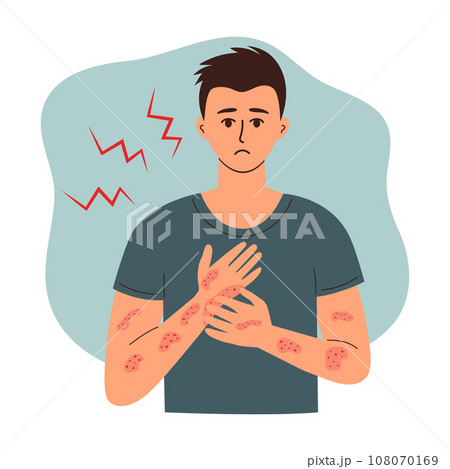 Sad man suffering from psoriasis, eczema or...のイラスト素材 [108070169] - PIXTA