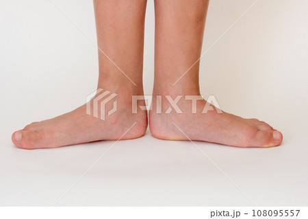 Cropped barefoot child legs Cropped barefoot child legs 108095557