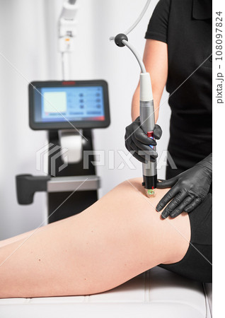 Close up of cosmetologist using microneedling device while performing radiofrequency treatment on female hip. Woman having skin tightening stretch marks removal procedure in beauty salon. Close up of cosmetologist using microneedling device while performing radiofrequency treatment on female hip. Woman having skin tightening stretch marks removal procedure in beauty salon. 108097824