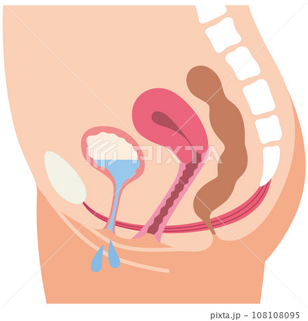 ゆるんでいる骨盤底筋と排尿の仕組み　尿もれ　健康 108108095