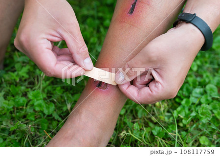 The hand of a young man applies a plaster to a fresh wound. Bad fall, ambulance on site. 108117759
