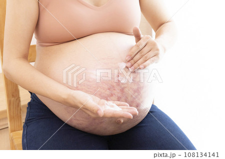 妊娠線ができたお腹にクリームを塗る女性の手と臨月のお腹 108134141