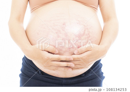妊娠線と正中線があるお腹に手をあてる臨月の女性 108134253