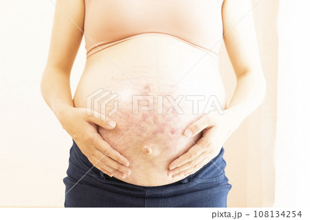 妊娠線と正中線があるお腹に手をあてる臨月の女性 108134254
