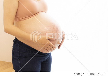 妊娠線と正中線があるお腹に手をあてる臨月の女性 108134256