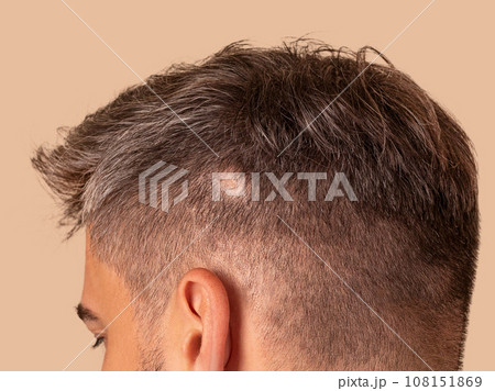 man with alopecia close up photo man with alopecia close up photo 108151869