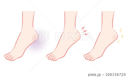 ガサガサ・粉ふき・つるつる　かかとのイラストまとめ 108156720