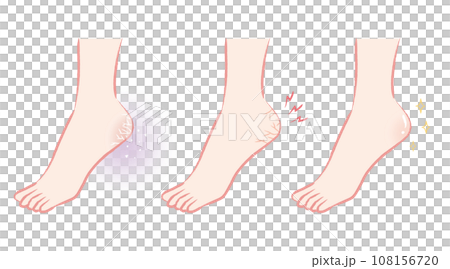 ガサガサ・粉ふき・つるつる　かかとのイラストまとめ 108156720