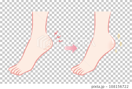 ガサガサかかと　つるつるかかと　ビフォーアフターのイラスト 108156722