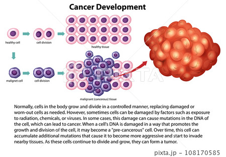 Cancer Development vector with information 108170585