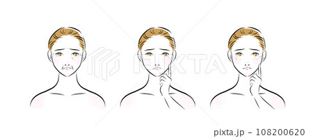 肌トラブルを抱えた女性の顔のイラスト　カラー1 108200620