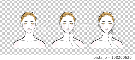 肌トラブルを抱えた女性の顔のイラスト　カラー1 108200620