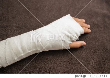 骨折や打撲、捻挫をして腕を固定するイメージ　俯瞰	 108204314