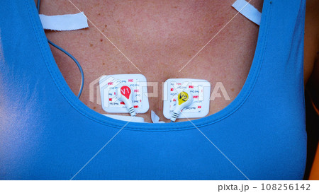 Unrecognizable woman with a device for daily monitoring of heart function on her chest. Halter. 108256142