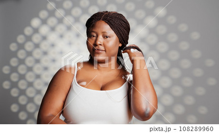 African american woman embracing imperfections and posing with bare skin, creating body prositivity and skincare campaign. Young beautiful adult promoting beauty products and self love. 108289960