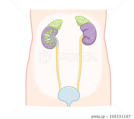 腎臓、kidney 、尿管、膀胱、bladder、イラスト、illustration 腎臓、kidney 、尿管、膀胱、bladder、イラスト、illustration 108331187